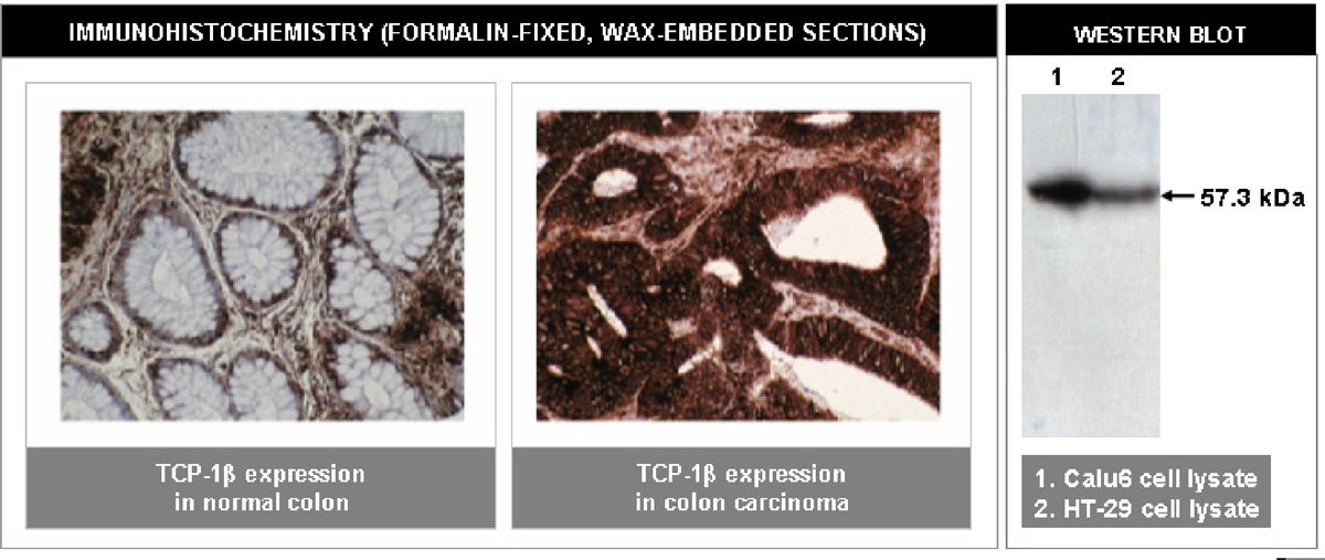 Mouse Anti Human T Complex Protein 1 Subunit Exalpha Biologicals Inc